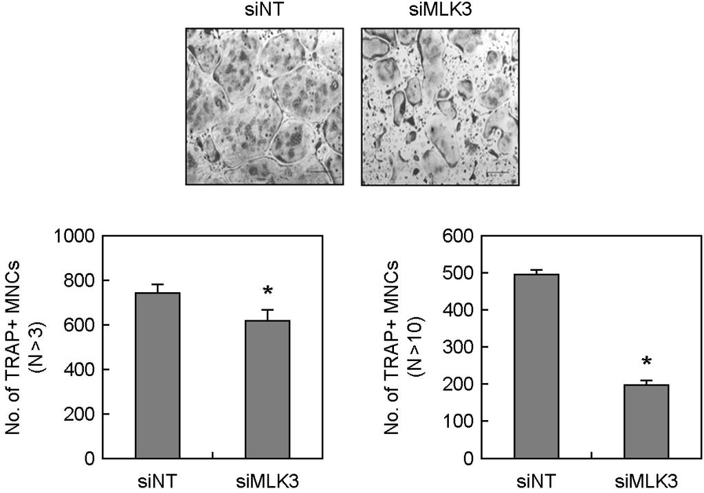 MLK1/ β-actin MLK2 / β-actin A B β-actin MLK3 / β-actin Cathepsin K / β-actin CTR / β-actin N.S. N.S. MLK3 / β-actin Fig. 4. Expression pattern of MLKs in BMM and OC.