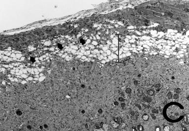 Figure 5. Effects of HBPDS on histopathological changes in ACD tissue.