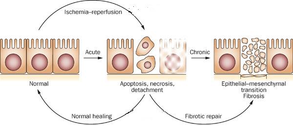 epithelial cells (arrows) & partial