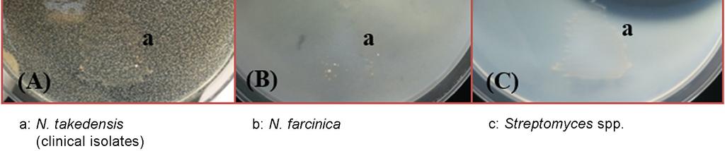 acid fast bacilli (upper right).