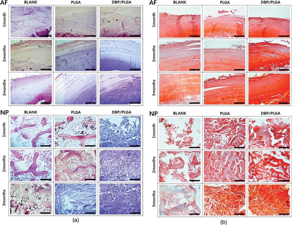 In vivo 상에서탈미네랄화된골분이함유된 PLGA 지지체를이용한추간판디스크재생 673 라겐합성량을봤을때 DBP/PLGA 군이 blank 군과 PLGA 군에비해수술 1, 2 및 3 개월이지난후콜라겐합성량이높게측정되는것을확인할수있었다. DBP/PLGA 군은 blank 군과비교하여수치상으로약 2 배이상콜라겐합성량이증가했다.