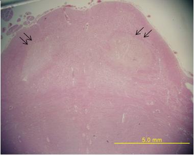 Gross findings demonstrated atrophy in dorsolateral prefrontal and superior medial frontal cortices and hippocampus ().