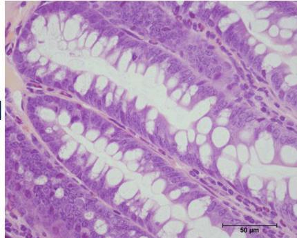 Songsri et al.: Animal models for Echinostoma malayanum infection 51 Hamster Rat Mouse Normal Infected Fig. 7. Representative histopathological changes in the small intestine of normal and E.