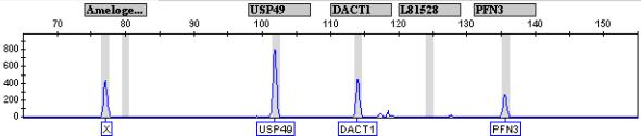 A. B. C. D. E. F. 그림 13. Results of mixture sample multiplex PCR tests Mixture of saliva and semen is detected S.