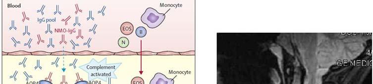 Desmoglein-3