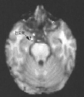 정서의측정 Measuring emotion Measuring Physiological measurements Brain scan 뇌의스캔은정서에다양한방식으로공헌하는뇌영역을확인하는것을돕는다.