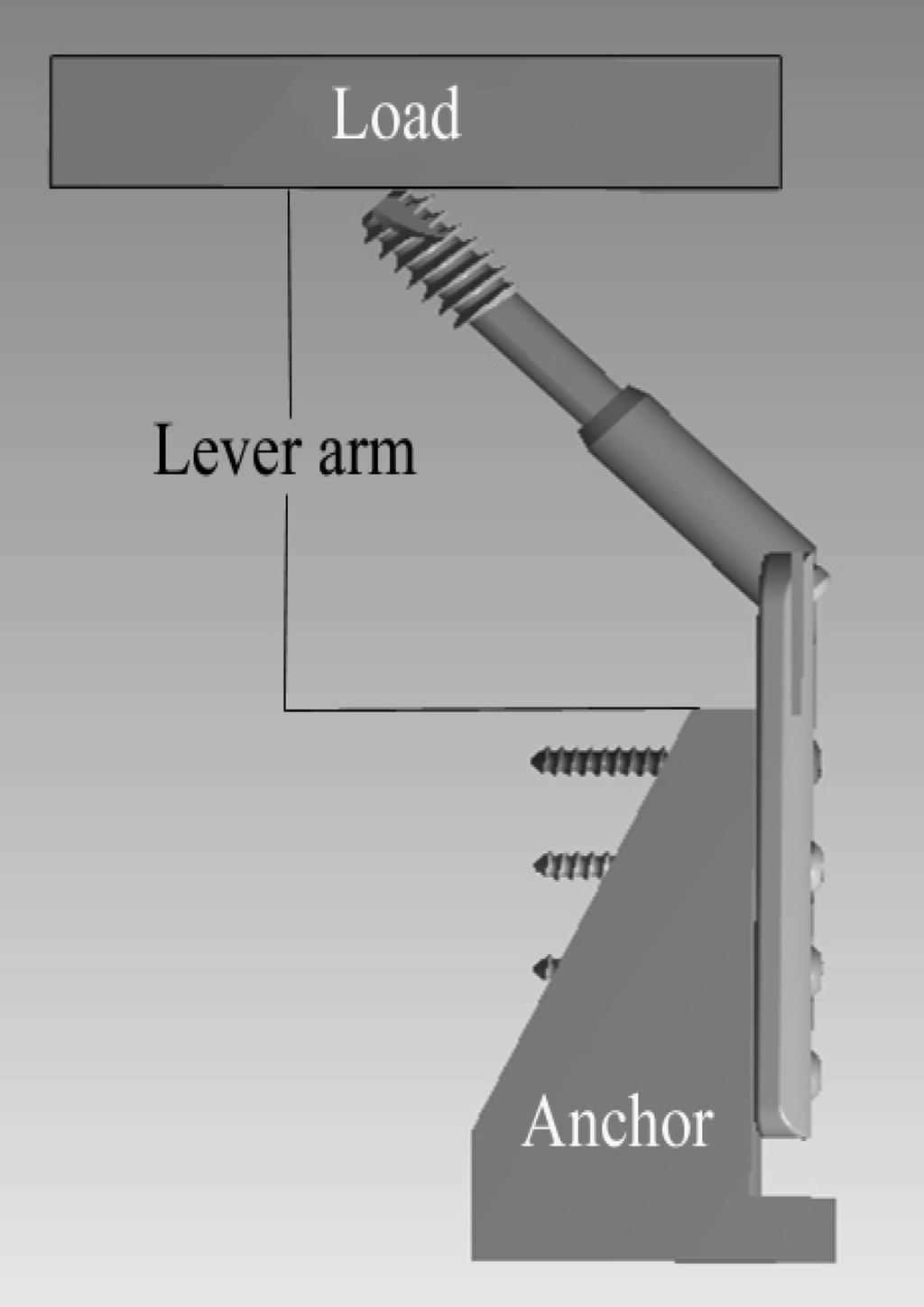 Components of a CHS. L: Lag screw, B: Barrel plate, S: Side plate, CP-S: Compression screw, CR-S: Cortical screw. 골나사 (cortical screw, CR-S) 를통하여고정되며바렐과 135 도의각도를이룬다.