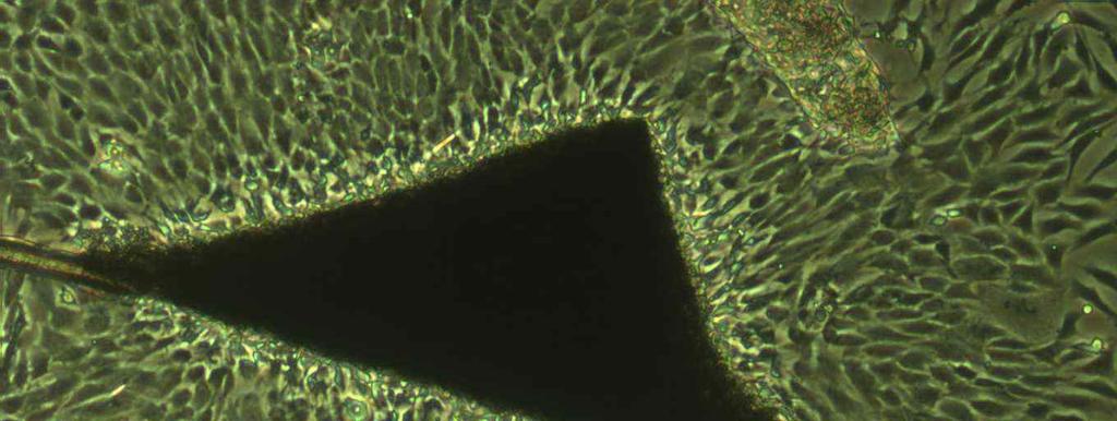 그림 15 조직으로부터자라나오는한우세포와세포의성별을위한 Karyotyping 사진 (XX) (2)