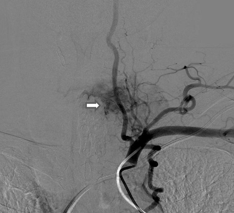 264 Korean J Endocrine Surg 2013;13:262-266 journal.kates.or.kr Fig. 3.