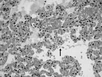 176 J. ENVIRON. TOXICOL. Vol. 21, No. 2 능성조사에서는눈에자극성이발현할수있는예측결과를나타내었고 Aerobic Biodegradability Model 에서는호기성생분해가능성이예측되었으며 LC 50 는 10 g/m 3 (1 h), 만성독성의최저영향농도 (LOAEL) 는 1.1 g/kg 으로예측되었다. 2. 급성흡입독성 100, 500, 2,500 ppm 군에서는일반증상변화나사망동물은없었으나 5,000 ppm 군의경우노출기간 (4 시간 ) 내 (15~24 분정도 ) 5 마리전량사망하였 으며노출완료후생존동물에는대조군을기준으로특이한임상적소견이나체중변화는없었다.