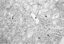 180 J. ENVIRON. TOXICOL. Vol. 21, No. 2 Table 4. Biochemical serum values in female SD rats after inhaled methylcyclohexane for 13 weeks Items Control 100 ppm 400 ppm 1,600 ppm AST 106.1±27.2 147.