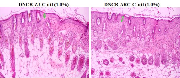 Atopic dermatitis NC/Nga mice were induced by DNCB treatment in the dorsal skin, before the treatment of DNCB (NC/Nga-Nr),