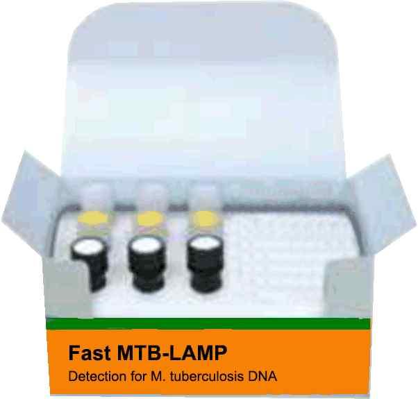 모델명 : Fast H1N1-LAMP 본제품은체외진단용의료기기 ( 시약 )(LAMP master-mix, MTB oligonucleotide, MTB positive control) 와구성품 (RNase/DNase free tube) 로구성된다.