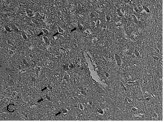 forstatic blood treatedgroup, 400) (2)BCL-2 염색 흰쥐의 cortex 부분에서 BCL-2 단백질발현을