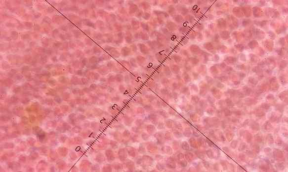 세포내에 녹새을 띠 는 알갱이를 볼 수 황색을 띄는 세포들 표본 6 사진 장소