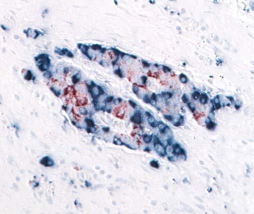 Most of cells in the islet consist of beta cells (red) and the remnants cosisting of alpha cells (blue) are positioned at