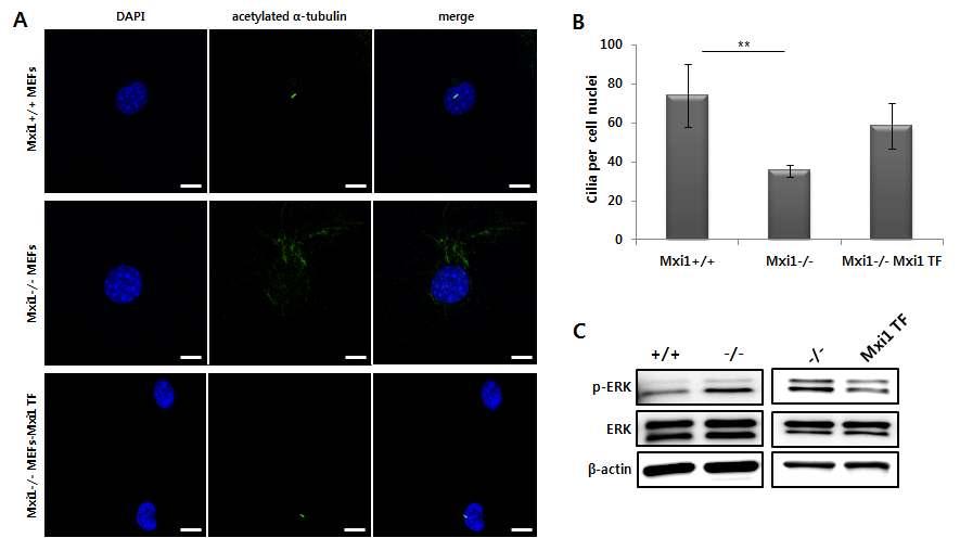 분이 control과는다르게조금짧아진것을확인하였고 acetylated a-tubulin으로염색된부분이감소한것을확인하였음.