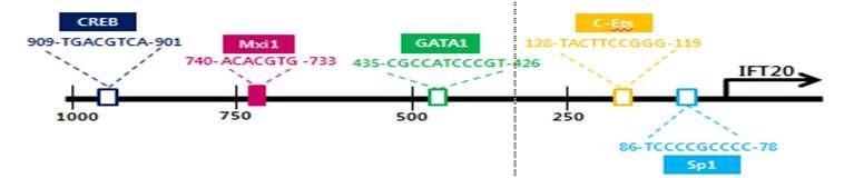 Mxi1 유전자의발현에의한 mimcd3의 ciliogenesis 조절 (A) mimcd3에 Con-siRNA 와 Mxi1-siRNA 처리한후 cilia 표현형관찰 (B) mimcd3에 Con-siRNA 와 Mxi1-siRNA 처리한후