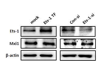 . 그림 17. Mxi1 과발현에의한 Ets-1 발현레벨검증및 Ets-1 과발현및감소를통한 Mxi1 발현레벨검증 그결과, Mxi1 단백질을과발현시킨 mimcd-3에서 Ets-1의발현이증가하는것을확인하였음. 이를통해, Mxi1 단백질이 Ets-1 단백질의발현을조절하여 Ift20 발현에영향을미칠수있는가능성을제시할수있음.