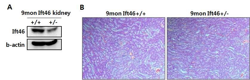 type embryo 와 hetero embryo 의표현형에특별한차이점이없었음. Ift46 KO embryo 의 lethal 시기가초기에일어나는것을확인한뒤, Ift46 hetero 마우스의 신장표현형을관찰해보았음 ( 그림 31)