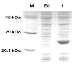 그림 2. (in vivo 시료 ) E. coli cell lysate 로부터목적단백질정제 A. DUSP3 가과발현된 E.