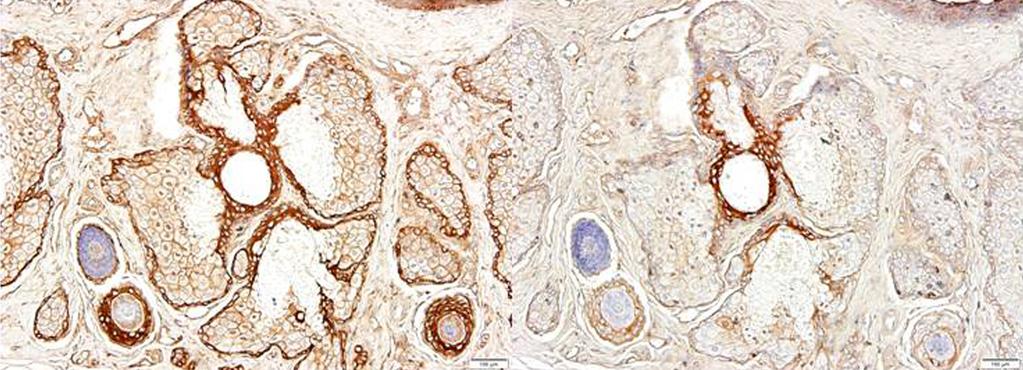 In the case of mouse, the size of the lobules and the central ducts was small, so that the difference between CK 5 and CK 6 was not apparent ().