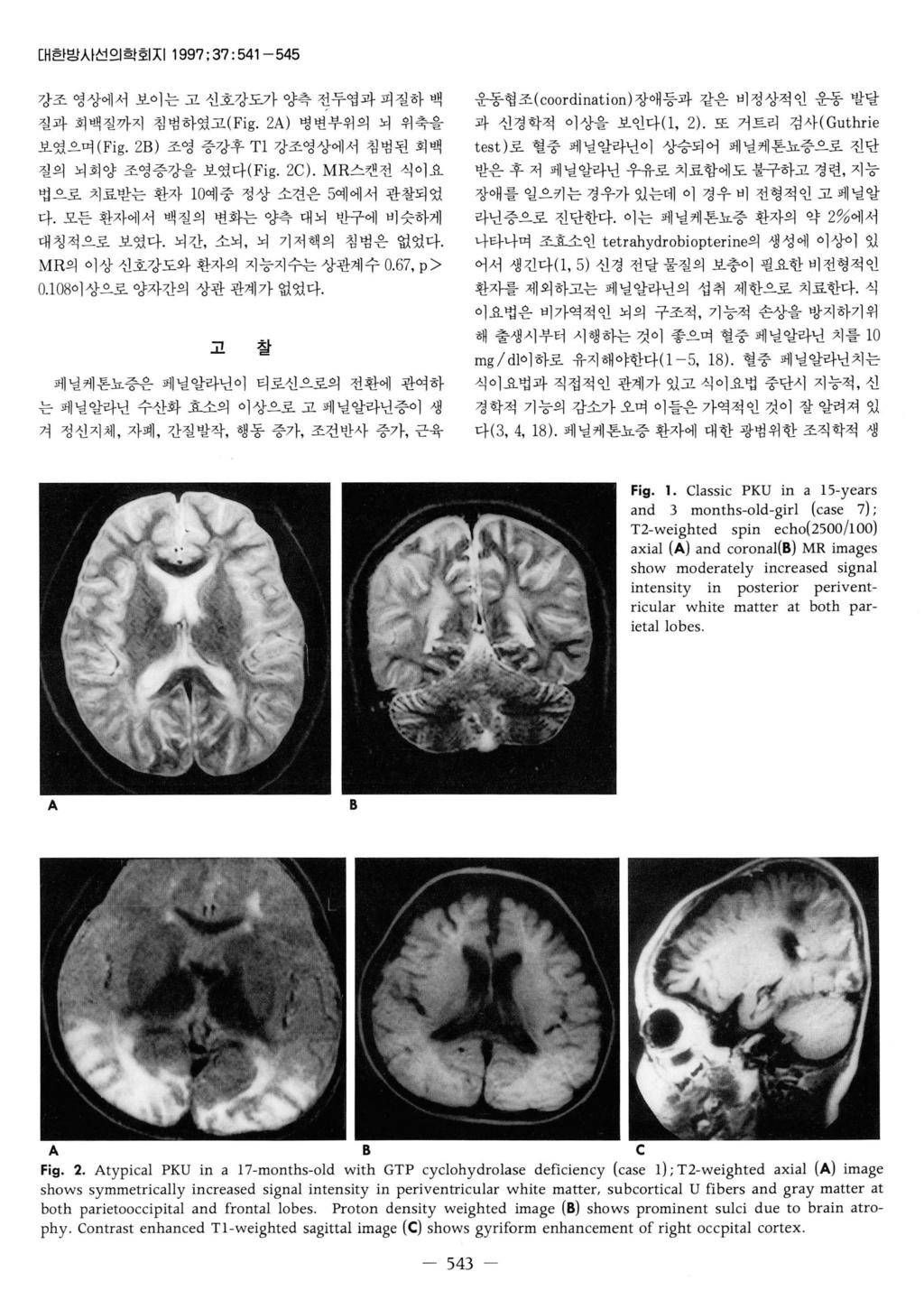 대한밤시선의학회지 1997; 37:541-545 강조영상에서보이는고신호강도가양측전두엽과피질하백 질과회백질까지침범하였고 (Fig. 2A) 병변부위의뇌위축을 보였으며 (Fig. 2B) 조영증강후 T1 강조영상에서침범된회백 절의뇌회양조영증강을보였다 (Fig. 2C). MR 스캔전식이요 법으로치료받는환자 10 예중정상소견은 5 예에서관찰되었 다.