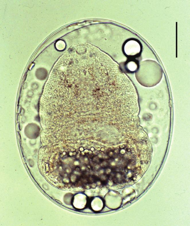 thick-walled expulser, and a D-shaped excretory bladder (EB) with grouped granules. Scale bar = 50 μm. B) S.