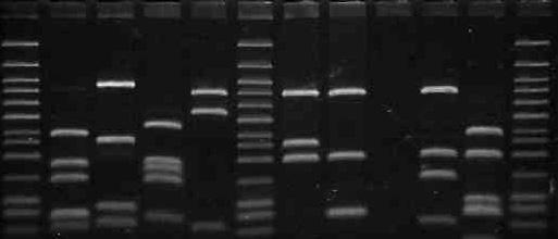 Clincal isolates of mycobacteria were used for PCR amplification using primers RPO5' and RPO3'. PCR products were run on a 2% agarose gel.