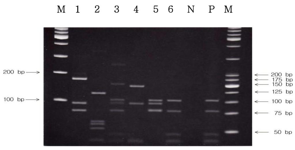 Korean J Clin Lab Sci. Vol. 47, No. 2, Jun. 2015 87 A B C Fig. 5. (A) PCR RFLP analysis using cultured colony of acid-fast bacillus smear-positive specimens.