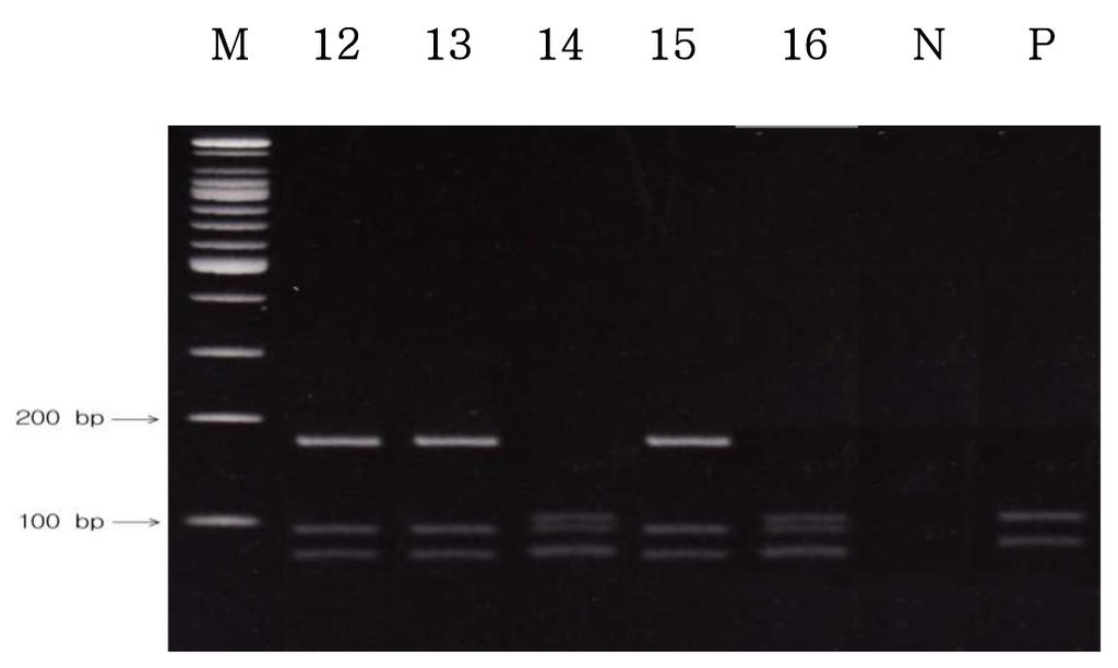 abscessus; 4, M. intracellulare; 5, M. abscessus; 6, M. avium; N, negative control, distilled water; P, positive control, M. avium. (B) PCR RFLP analysis using cultured colony of acid-fast bacillus smear-positive specimens.