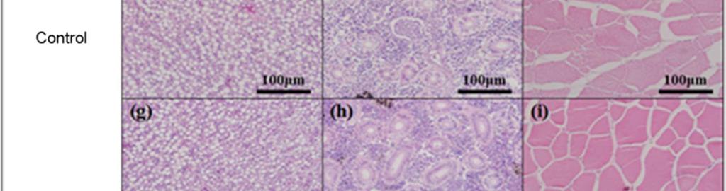 , 2012) 과심한저칼륨혈증, 동성맥, heart block 을야기할수있는 double peaked T-waves 의증가 (Lionte et al., 2012) 등의증상이발생할수있다. 조혈활성은평소에는휴지기였다가혈중내에세균이나약물이침투하게되었을때활성이나타난다.