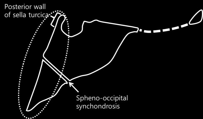 16 우수증례심사안내서 Figure 1. Posterior cranial base. Figure 2.