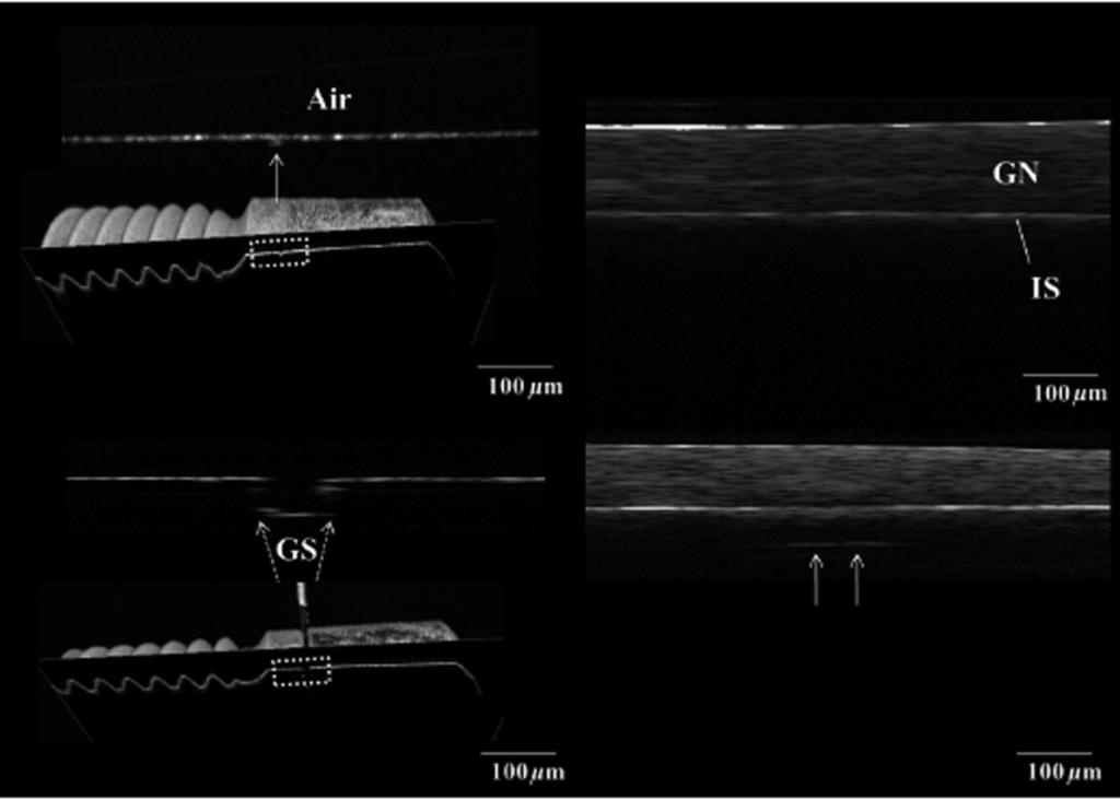 A B C D Fig. 8. Measurement of marginal fit between implant and abutment using 3-D OCT.