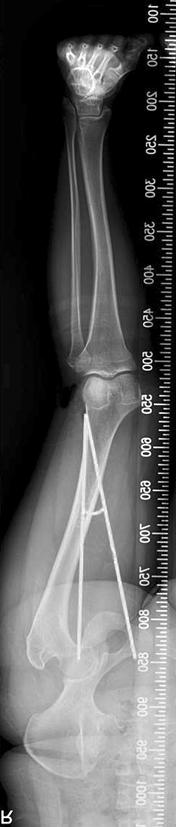 287 Osteotomy around the Knee 전위및전방십자인대의인장력을증가시켜후방십자인대결손시나타나는경골의후방아탈구가감소하게된다. 반대로후방경골경사가감소하면과신전이발생하고후방전위및후방십자인대의인장력을증가시켜전방십자인대결손시나타나는경골의전방아탈구가감소하게된다.