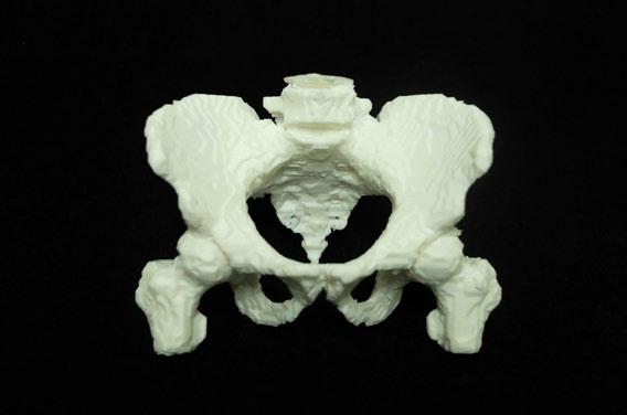 Fused Filament Fabrication (FFF) 15.