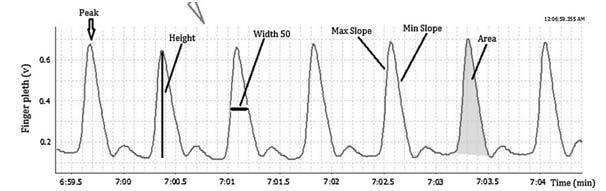 Fig. 1. Finger PPG waveform parameters; Height, Width 50, Area, Max and Min slopes [3] (ref 3). pliance가증가하면 PPG waveform의 amplitude는증가하게된다.