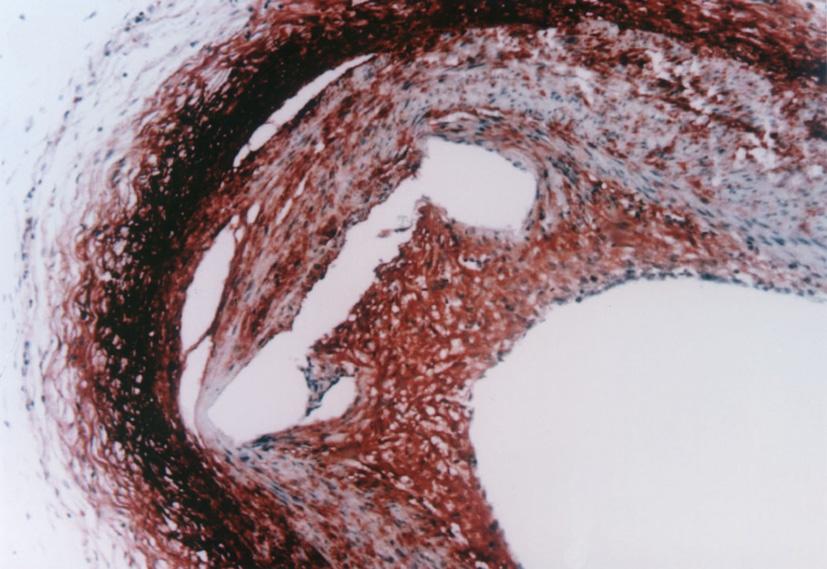 6±10.5% 이었다 (Ⅰ군대 Ⅱ Collagen과 Proteoglycan의분포세포외기질은 Modified Movat 염색에서 proteoglycan은청색, collagen은황색으로염색되었고 collagen과 proteoglycan이혼합된부분은녹색으로염색이되었으며, elastin