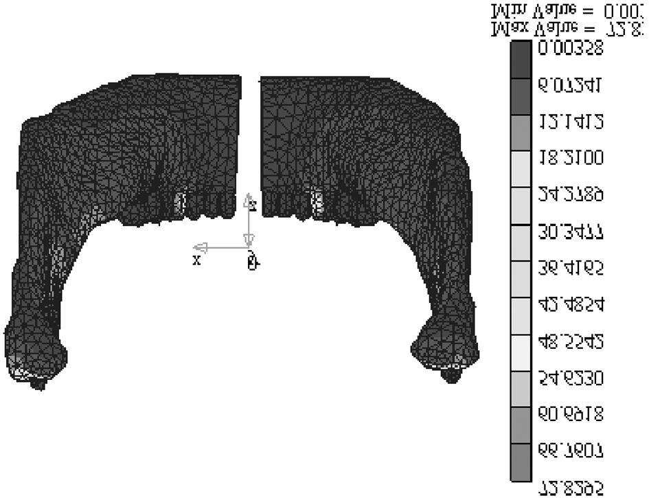 Von Mises응력은힘적용부치아와과두에서가장컸다. 실험군 2 ( 혼합형장치 : Figs 2 and 15-17) 하악골에서좌우골편들의협측변위양상을보였 는데우각부위에서가장컸다.